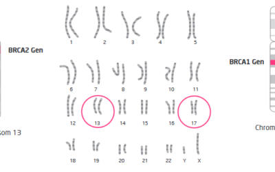 Γενετική προδιάθεση καρκίνου μαστού – ωοθηκών