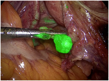 Φρουρός ΛΦ3