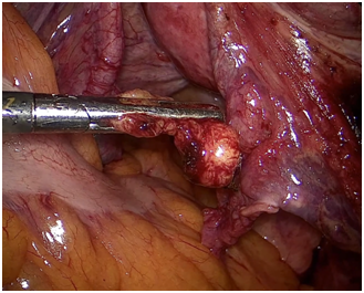 Φρουρός ΛΦ4